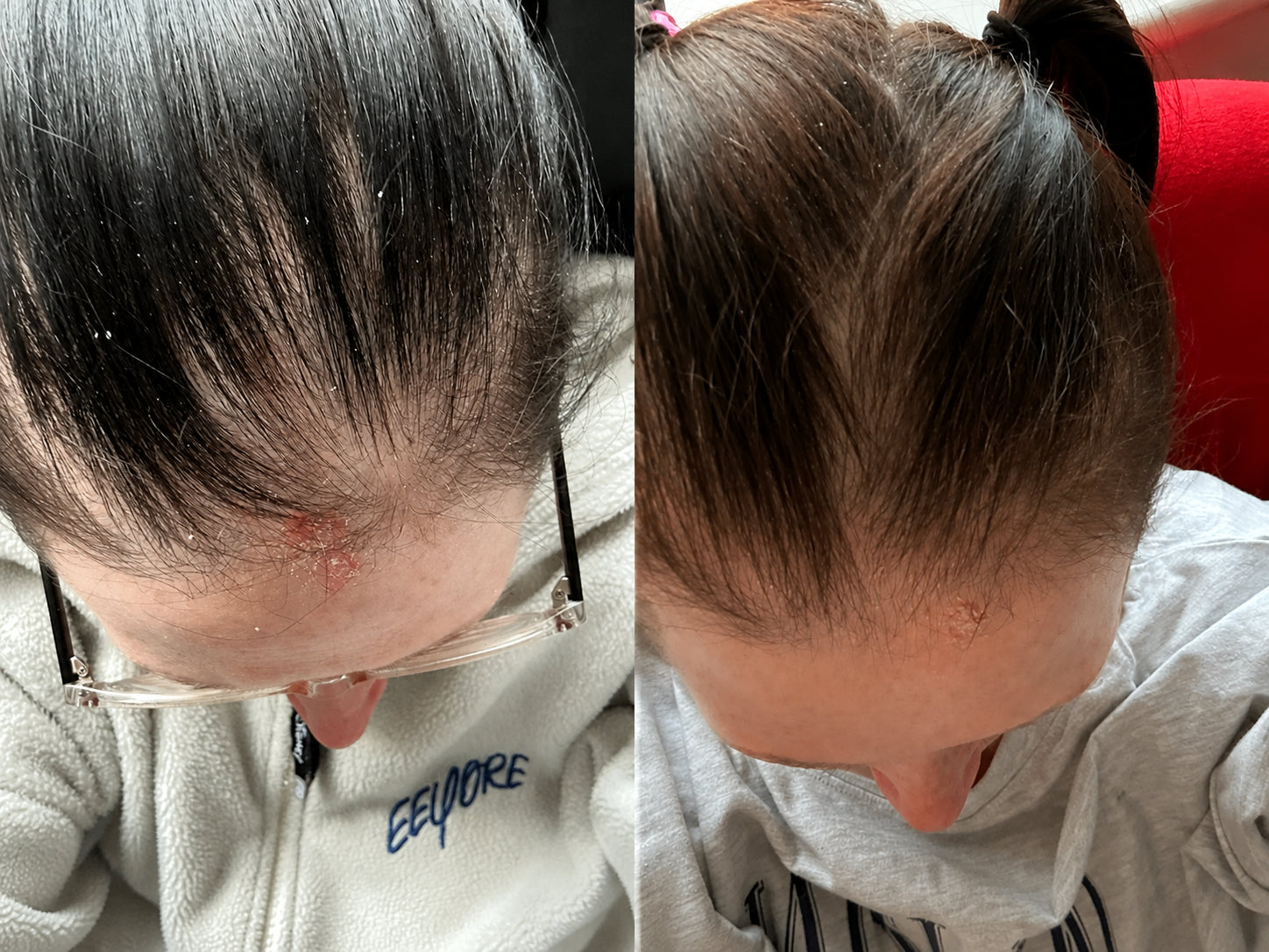 Comparación del cabello durante el segundo mes de la rutina